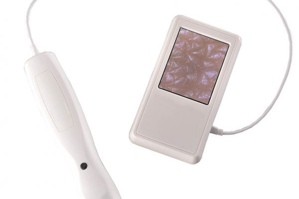 Visioscope&reg; Palm VP 25